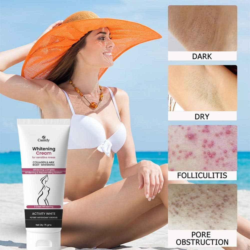 Cassidy Whitening Cream 150 gms Pack of 2